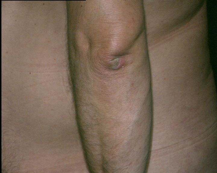 07181041